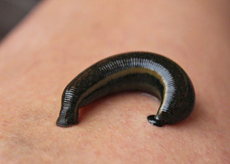 Leech Therapy in Ayurveda (With Photos), A Definitive Guide